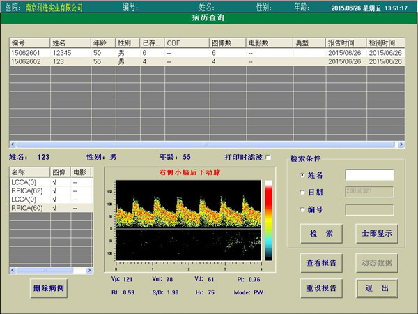 經(jīng)顱多普勒報(bào)告查詢界面.jpg