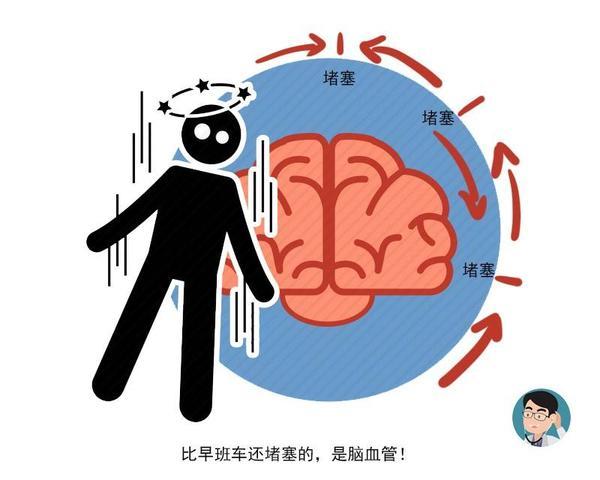 腦中風發作前的四個癥狀 謹防中風猝死